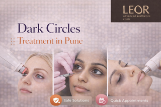 Dark Circles Treatment in Pune: Best Solutions for Visible Results