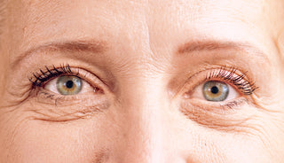 Close-Up of Woman’s Eyes After Skin Treatment