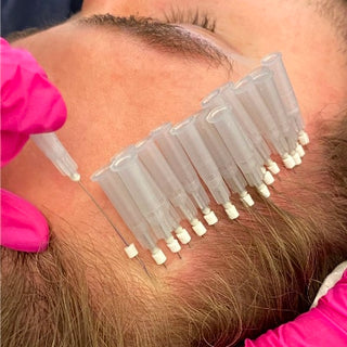 Hair Threads Treatment at Leor Clinic