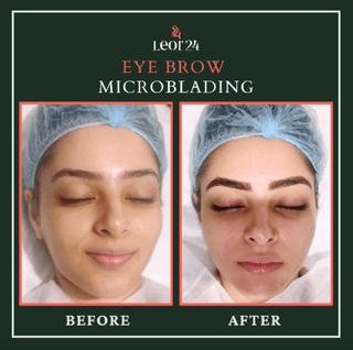Eyebrow Microblading - Leor Clinic Skin Treatments for Healthy Skin