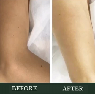 Leor Clinic - Skin Treatment Options