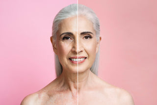 Face skin treatment - Before & After Results