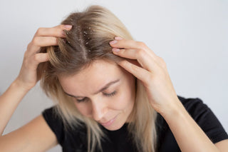 Woman with dandruff. Scalp treatment needed