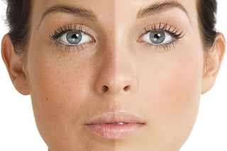 Treatments for Uneven Skin Tone at Leor Clinic